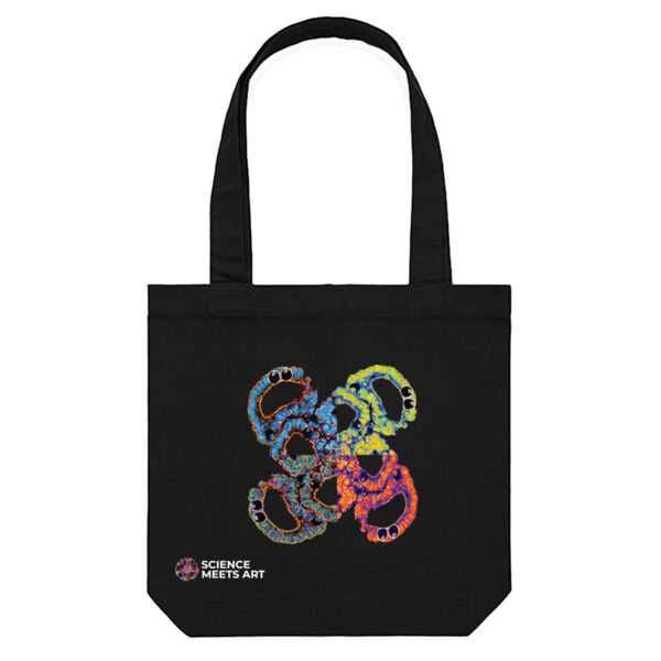 Gut in loops Thumbnail